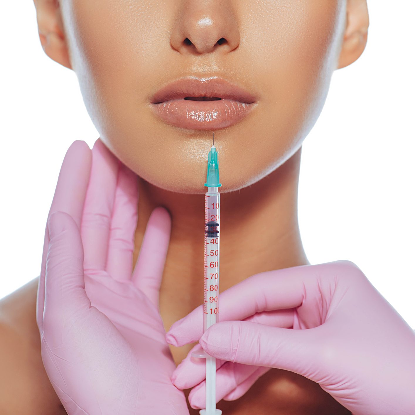 Et bilde av nedre del av en kvinnes ansikt. En filler-nål er holdt ved siden av leppen hennes av en lege med hansker. 